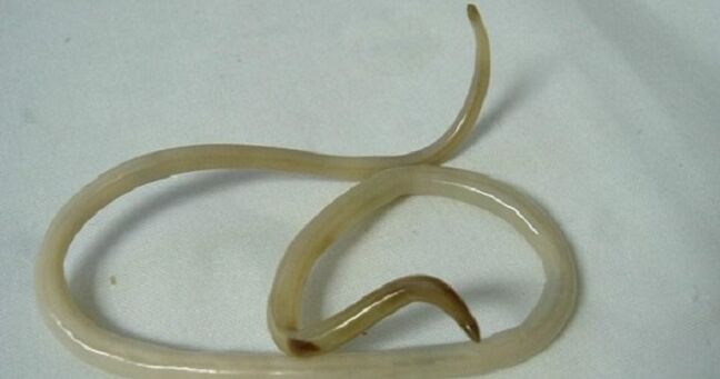 parasitic worms from a child's body