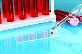 Hemoscany of blood drops for parasites