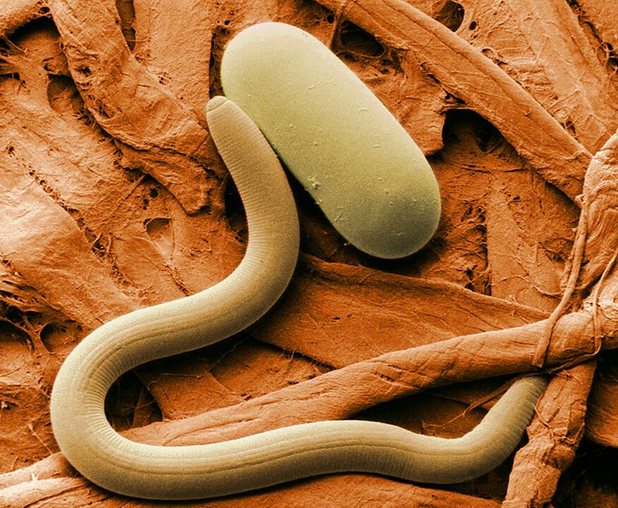 The parasite under a microscope