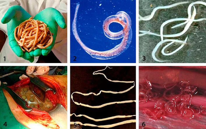 The types of parasites