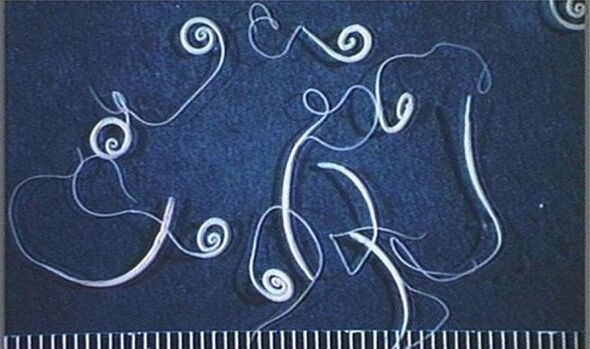 whipworms from the human body