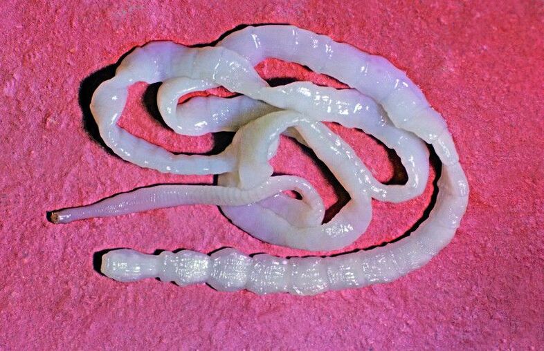 Bovine tapeworm is a common intestinal helminth.