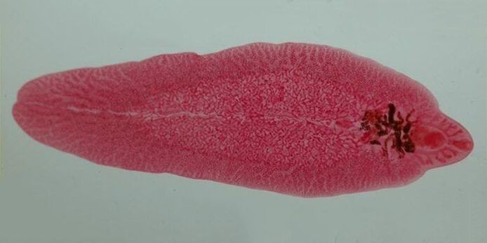 fluke worm in humans