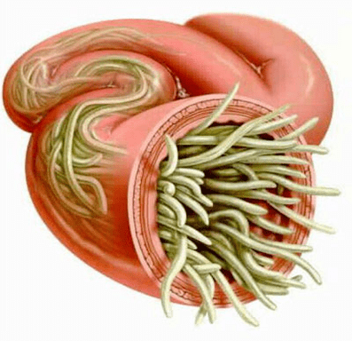 round worm in the human intestine