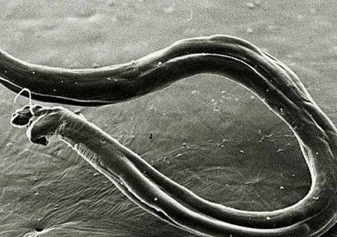 what do fat worms look like in the human body